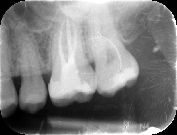 MACIULSKIENERASA_000