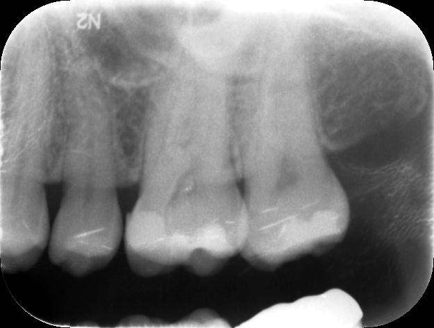 MACIULSKIENERASA_001